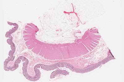 Human colon